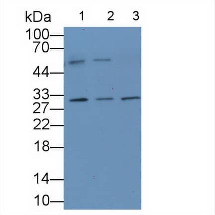 Western Blot: IL-36 alpha/IL-1F6 Antibody (C1) [NBP3-41659] - Lane 1: Porcine Cerebrum lysate; Lane 2: Rat Cerebrum lysate; Lane 3: Human U87MG cell lysate; Primary Ab: 2ug/ml NBP3-41659; Second Ab: 0.2ug/mL HRP-conjugated Rabbit Anti-Mouse IgG Polyclonal Antibody