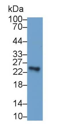 Western Blot: USAG1/SOSTDC1 Antibody (C1) [NBP3-41661] - Sample: Human Milk Primary Ab: 2ug/ml NBP3-41661; Second Ab: 0.2ug/mL HRP-Linked Caprine Anti-Mouse IgG Polyclonal Antibody