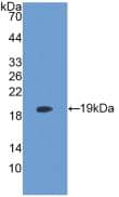 Western Blot: LPCAT3 Antibody (6-2#) [NBP3-41662] - Sample: Recombinant LPCAT3, Human.