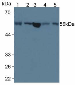 Western Blot: LPCAT3 Antibody (6-2#) [NBP3-41662] - Sample: Lane1: Human Serum; Lane2: Porcine Liver Tissue; Lane3: Human Liver Tissue; Lane4: Porcine Pancreas Tissue; Lane5: Porcine Kidney Tissue Primary Ab: 5ug/ml NBP3-41662; Second Ab: 0.2ug/mL HRP-Linked Caprine Anti-Mouse IgG Polyclonal Antibody