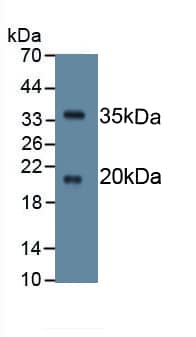 Western Blot: SPINK5 Antibody (C10) [NBP3-41666] - Sample: Recombinant SPINK5, Human.