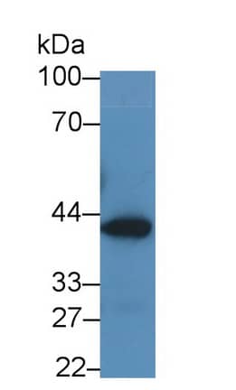 Western Blot: Glutaminyl-peptide Cyclotransferase/QPCT Antibody (C2) [NBP3-41667] - Sample: Human Urine Primary Ab: 2ug/ml NBP3-41667; Second Ab: 0.2ug