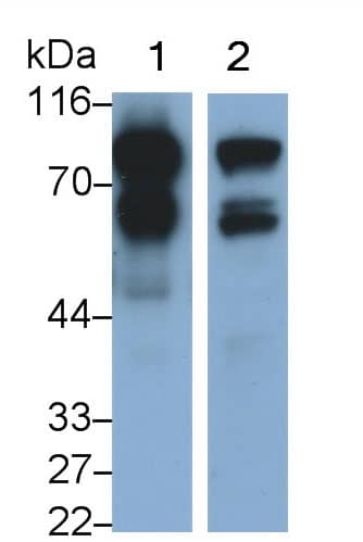 Western Blot: Nexilin Antibody (D6) [NBP3-41668] - Samples: Lane1: Rat Heart lysate; Lane2: Rat Cerebrum lysate; Primary Ab: 0.2ug/ml NBP3-41668; Second Ab: 0.2ug/ml HRP-Linked Caprine Anti-Mouse IgG Polyclonal Antibody