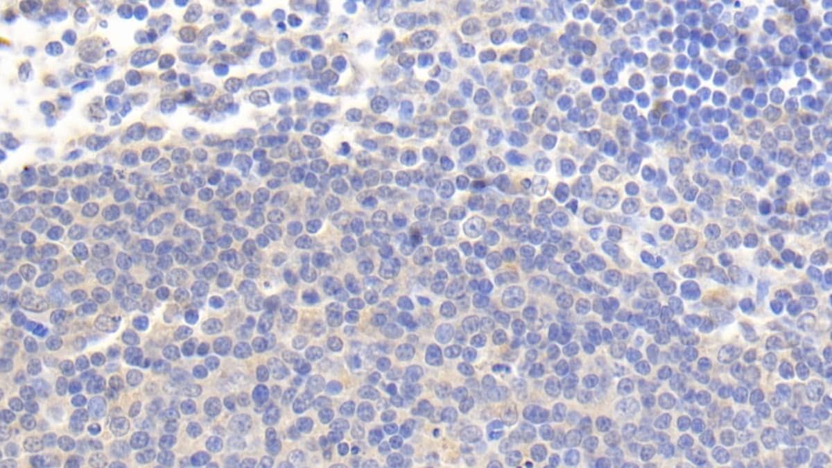 Immunohistochemistry-Paraffin: IL-4I1 Antibody (C2) [NBP3-41670] - DAB staining on IHC-P; Sample: Human Lymph node Tissue; Primary Ab: 20ug/ml NBP3-41670; Second Ab: 2ug/mL HRP-Linked Caprine Anti-Mouse IgG Polyclonal Antibody