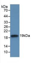 Western Blot: IL-18 BPa/IL18BP Antibody (5-2#) [NBP3-41671] - Sample: Recombinant IL-18 BPa/IL18BP, Human.