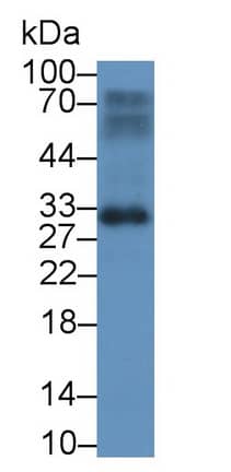 Western Blot: BASP1 Antibody (C2) [NBP3-41674] - Sample: Rat Bladder lysate Primary Ab: 2ug/ml NBP3-41674; Second Ab: 0.2ug/mL HRP-Linked Caprine Anti-Mouse IgG Polyclonal Antibody