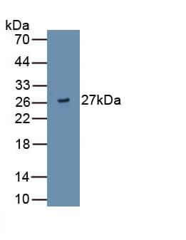 Western Blot: ADAMTS9 Antibody (D2) [NBP3-41677] - Sample: Recombinant ADAMTS9, Human.