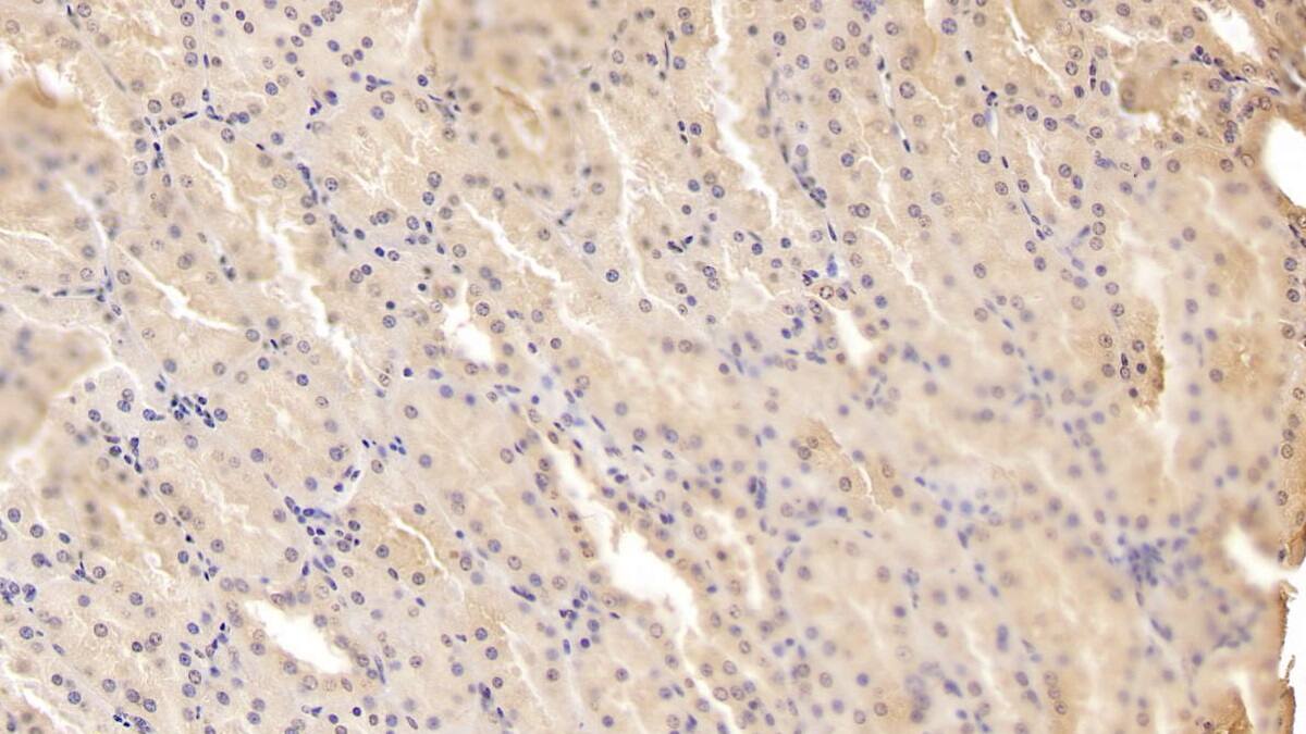 Immunohistochemistry-Paraffin: ADAMTS9 Antibody (D2) [NBP3-41677] - DAB staining on IHC-P; Sample: Human Kidney Tissue; Primary Ab: 20ug/ml NBP3-41677; Second Ab: 2ug/mL HRP-Linked Caprine Anti-Mouse IgG Polyclonal Antibody