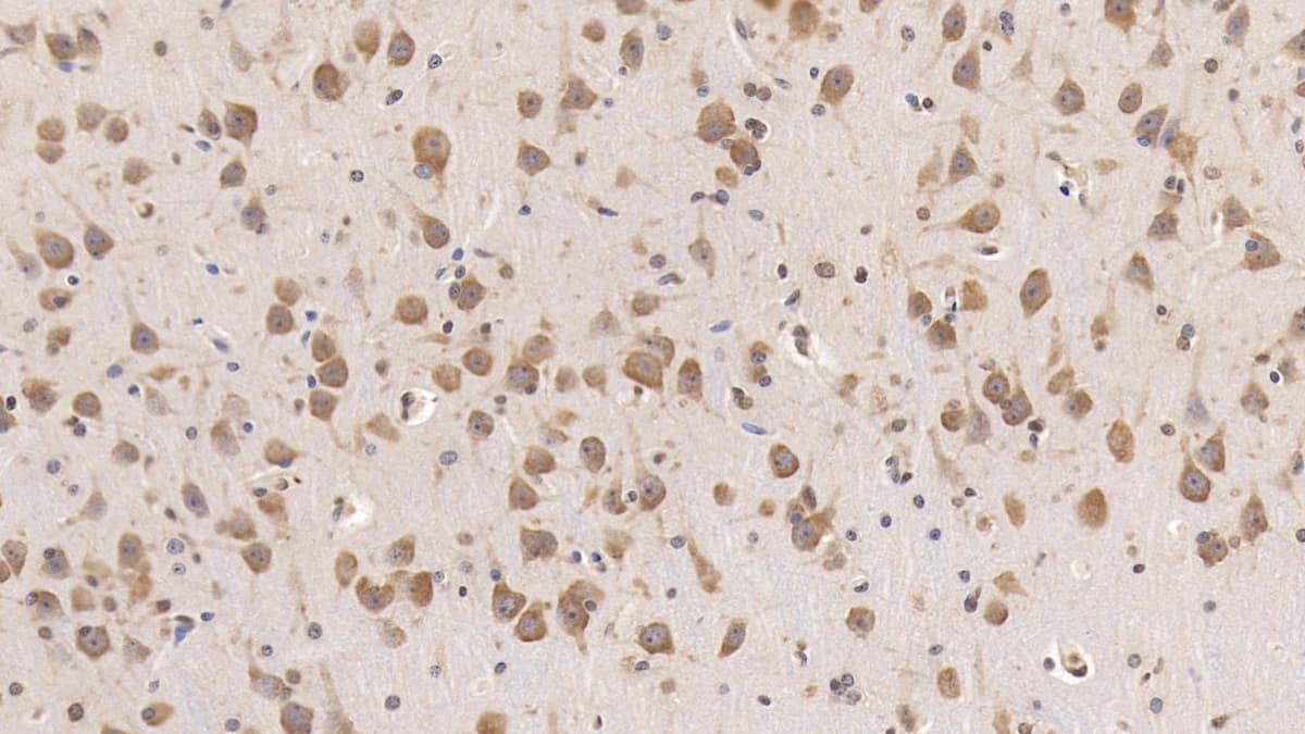 Immunohistochemistry-Paraffin: Rab5a Antibody (C4) [NBP3-41678] - DAB staining on IHC-P; Samples: Human Cerebrum Tissue; Primary Ab: 30ug/ml NBP3-41678; Second Ab: 2ug/mL HRP-Linked Caprine Anti-Mouse IgG Polyclonal Antibody