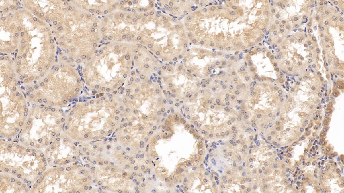 Immunohistochemistry-Paraffin: Rab5a Antibody (C4) [NBP3-41678] - DAB staining on IHC-P; Samples: Human Kidney Tissue; Primary Ab: 30ug/ml NBP3-41678; Second Ab: 2ug/mL HRP-Linked Caprine Anti-Mouse IgG Polyclonal Antibody