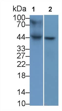 Western Blot: HLA B Antibody (C1) [NBP3-41679] - Sample: Lane1: Human Lung lysate; Lane2: Hela cell lysate Primary Ab: 2ug/ml NBP3-41679