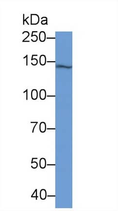 Western Blot: Isoleucyl tRNA synthetase Antibody (C1) [NBP3-41682] - Sample: A549 cell lysate Primary Ab: 2ug/ml NBP3-41682; Second Ab: 0.2ug/mL HRP-Linked Caprine Anti-Mouse IgG Polyclonal Antibody