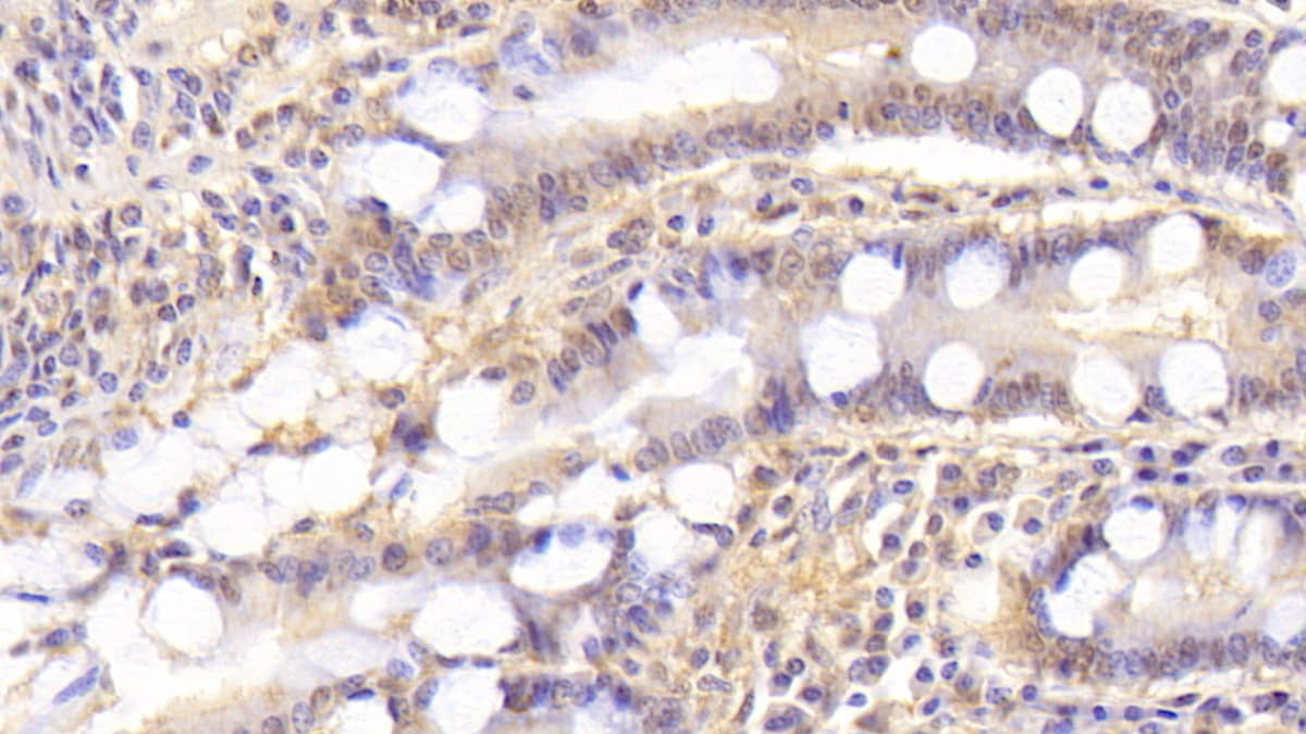 Immunohistochemistry-Paraffin Syntenin 2 Antibody (C1) - BSA Free