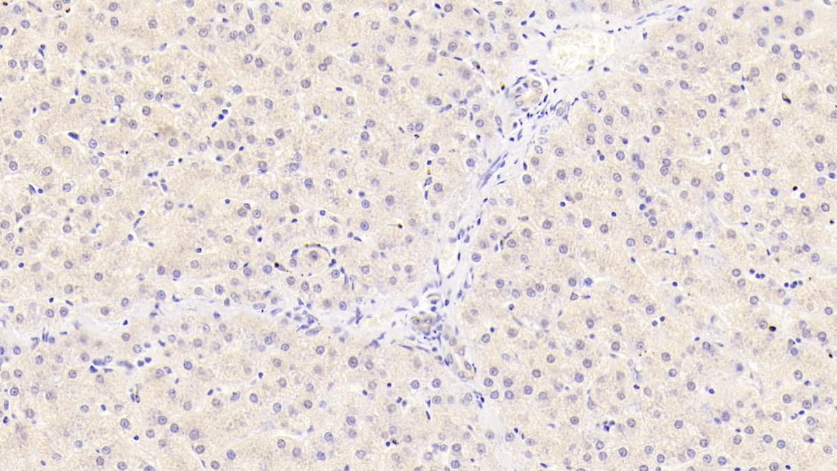 Immunohistochemistry-Paraffin: Syntenin 2 Antibody (C1) [NBP3-41684] - DAB staining on IHC-P; Samples: Human Liver Tissue; Primary Ab: 30ug/ml NBP3-41684; Second Ab: 2ug/mL HRP-Linked Caprine Anti-Mouse IgG Polyclonal Antibody