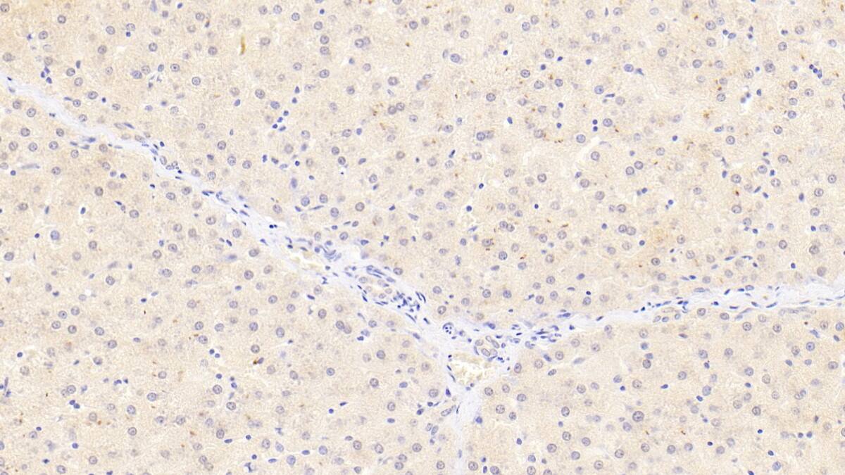 Immunohistochemistry-Paraffin: Monoglyceride Lipase Antibody (D3) [NBP3-41685] - DAB staining on IHC-P; Samples: Human Liver Tissue; Primary Ab: 30ug/ml NBP3-41685; Second Ab: 2ug/mL HRP-Linked Caprine Anti-Mouse IgG Polyclonal Antibody