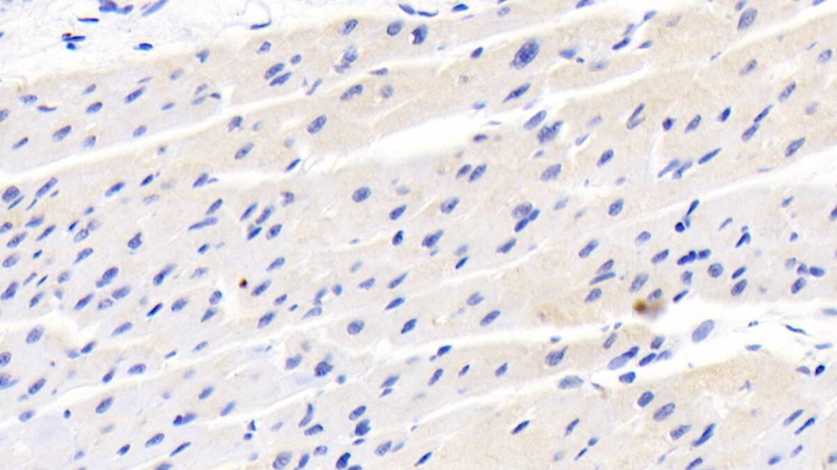 Immunohistochemistry-Paraffin: ACBP Antibody (C6) [NBP3-41686] - DAB staining on IHC-P; Sample: Human Cardiac Muscle Tissue; Primary Ab: 20ug/ml NBP3-41686; Second Ab: 2ug/mL HRP-Linked Caprine Anti-Mouse IgG Polyclonal Antibody