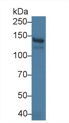 Western Blot: PLA2R1 Antibody (C6) [NBP3-41687] - Human Serum; Primary Ab: 3ug/ml NBP3-41687; Second Ab: 0.2ug/mL HRP-conjugated Goat Anti-Mouse IgG Polyclonal Antibody