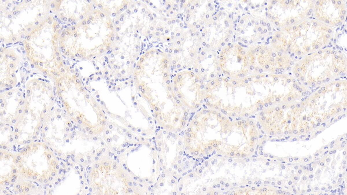 Immunohistochemistry-Paraffin: S100A3 Antibody (C5) [NBP3-41689] - DAB staining on IHC-P; Samples: Human Kidney Tissue; Primary Ab: 30ug/ml NBP3-41689; Second Ab: 2ug/mL HRP-Linked Caprine Anti-Mouse IgG Polyclonal Antibody