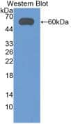 Western Blot: ALDH7A1 Antibody (7#) [NBP3-41693] - Western Blot; Sample: Recombinant ALDH7A1, Human.