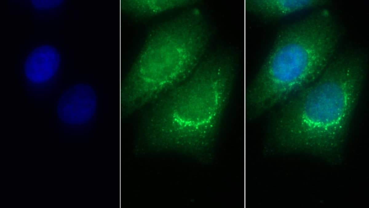 Immunocytochemistry /Immunofluorescence: PSAP Antibody (D12) [NBP3-41708] - FITC staining on IF; Sample: Human HepG2 cell; Primary Ab: 30ug/ml NBP3-41708; Second Ab: 2ug/ml FITC-Linked Caprine Anti-Mouse IgG Polyclonal Antibody