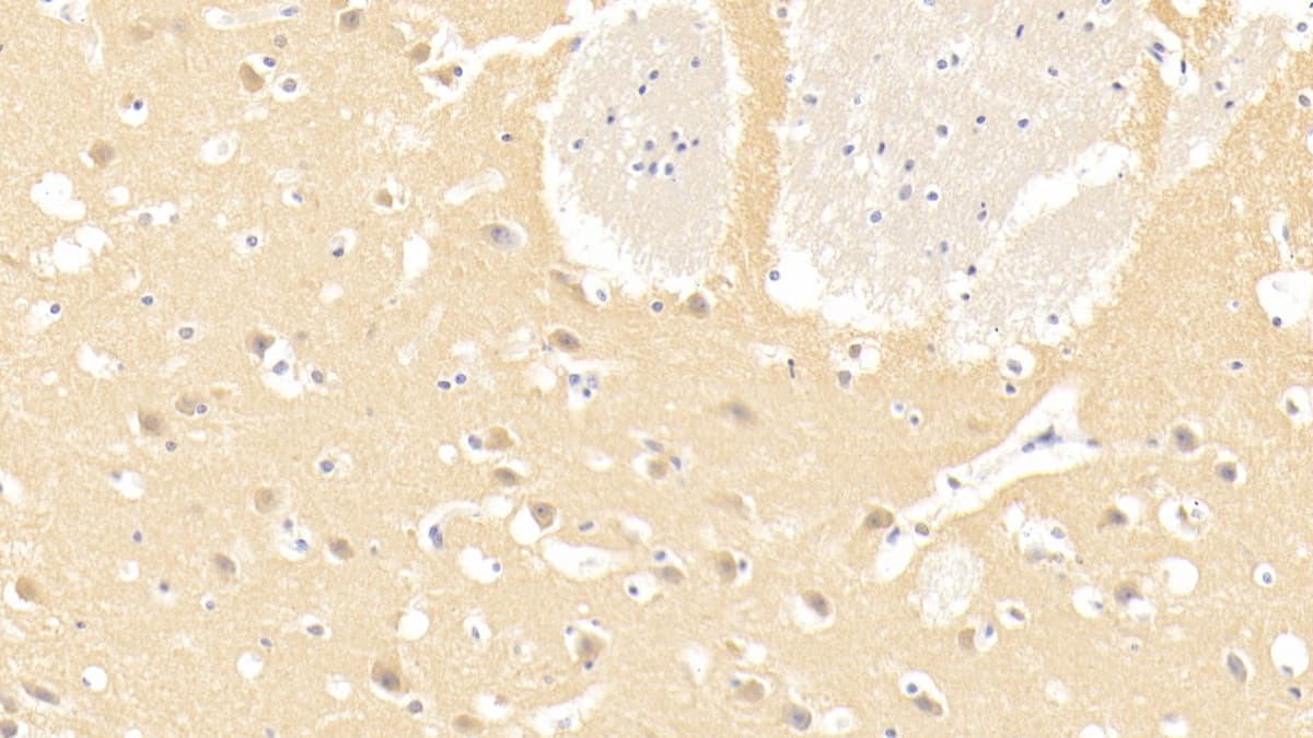 Immunohistochemistry-Paraffin: Laminin alpha 3 Antibody (C3) [NBP3-41717] - DAB staining on IHC-P; Sample: Human Cerebrum Tissue; Primary Ab: 20ug/ml NBP3-41717; Second Ab: 2ug/mL HRP-Linked Caprine Anti-Mouse IgG Polyclonal Antibody