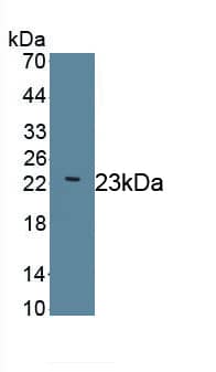 Western Blot: LAMC2 Antibody (D7) [NBP3-41718] - Sample: Recombinant LAMC2, Human.