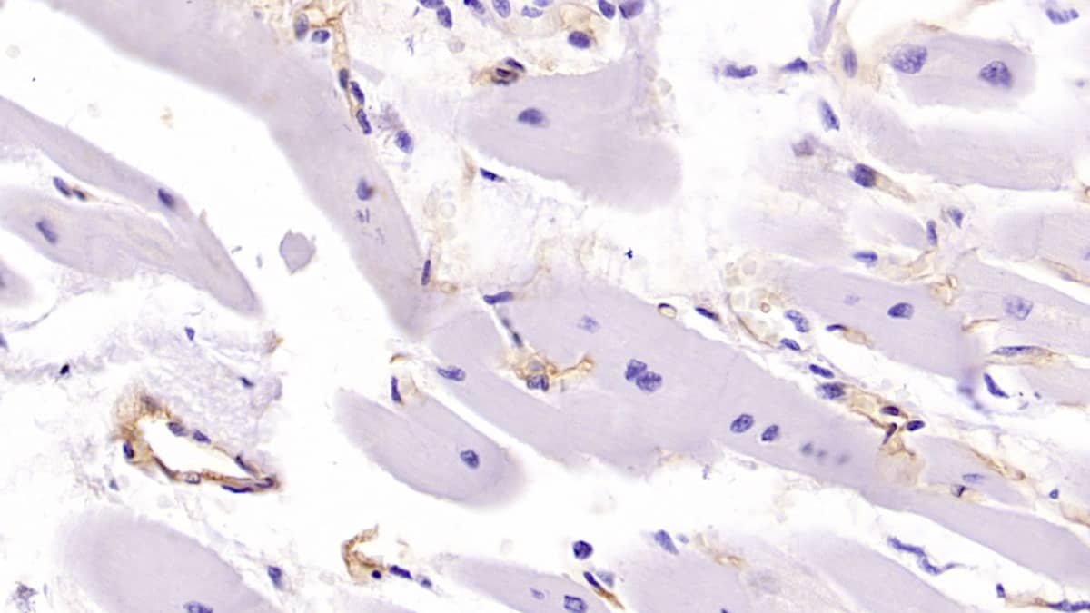 Immunohistochemistry-Paraffin: HLA C Antibody (C19) [NBP3-41719] - DAB staining on IHC-P; Samples: Human Cardiac Muscle Tissue; Primary Ab: 40ug/ml NBP3-41719; Second Ab: 2ug/mL HRP-Linked Caprine Anti-Mouse IgG Polyclonal Antibody