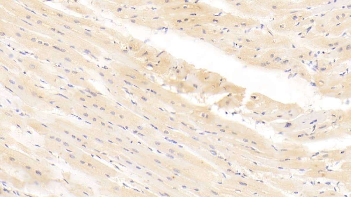 Immunohistochemistry-Paraffin: Integrin alpha 11 Antibody (C1) [NBP3-41720] - DAB staining on IHC-P; Samples: Human Cardiac Muscle Tissue; Primary Ab: 30ug/ml NBP3-41720; Second Ab: 2ug/mL HRP-Linked Caprine Anti-Mouse IgG Polyclonal Antibody