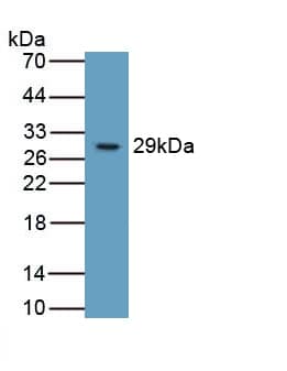 Western Blot: Integrin beta 6 Antibody (C5) [NBP3-41721] - Western Blot Sample: Recombinant Integrin beta 6, Human