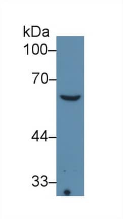 Western Blot: Collagen VIII alpha 1 Antibody (C3) [NBP3-41722] - Sample: Sp2/0 cell lysate; Primary Ab: 2ug/ml NBP3-41722; Second Ab: 0.2ug/mL HRP-Linked Rabbit Anti-Mouse IgG Polyclonal Antibody