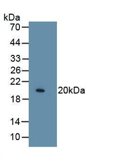 Western Blot: Collagen VIII alpha 1 Antibody (C3) [NBP3-41722] - Sample: Recombinant Collagen VIII alpha 1, Human.