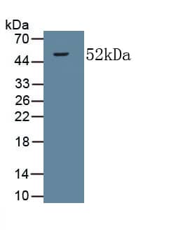 Western Blot: Collagen V alpha 2 Antibody (C4) [NBP3-41724] - Sample: Recombinant Collagen V alpha 2, Human.