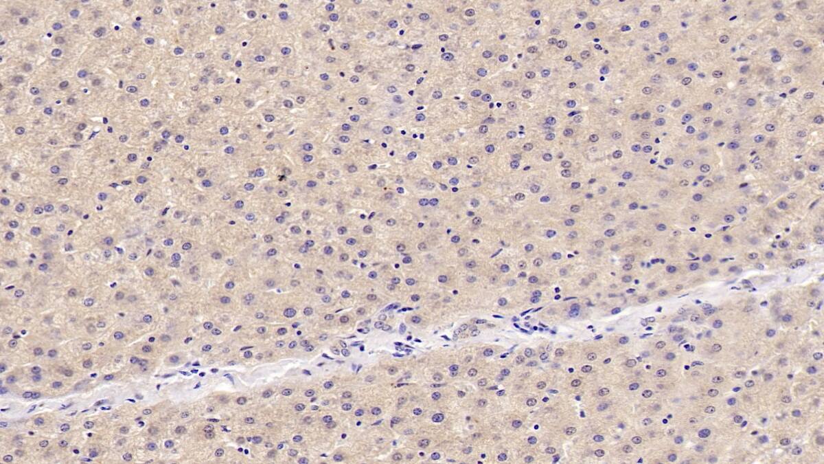 Immunohistochemistry-Paraffin: OAS1 Antibody (C5) [NBP3-41727] - DAB staining on IHC-P; Samples: Human Liver Tissue; Primary Ab: 40ug/ml NBP3-41727; Second Ab: 2ug/mL HRP-Linked Caprine Anti-Mouse IgG Polyclonal Antibody