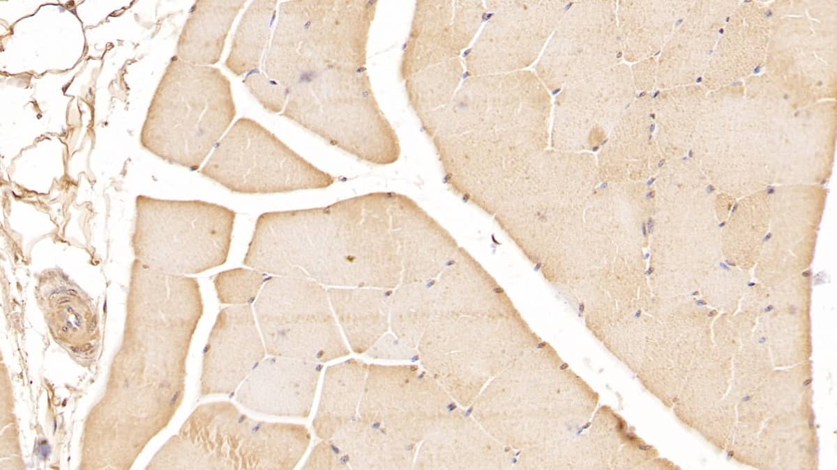 Immunohistochemistry-Paraffin: VHR/DUSP3 Antibody (2#) [NBP3-41728] - DAB staining on IHC-P; Samples: Human Skeletal muscle Tissue; Primary Ab: 10ug/ml NBP3-41728; Second Ab: 2ug/mL HRP-Linked Caprine Anti-Mouse IgG Polyclonal Antibody