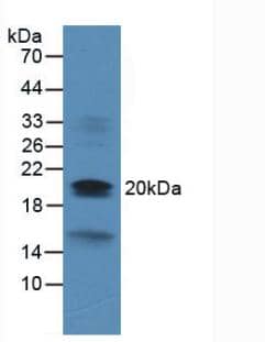 Western Blot: VHR/DUSP3 Antibody (2#) [NBP3-41728] - Sample: Rat Heart Tissue.