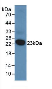 Western Blot: VHR/DUSP3 Antibody (2#) [NBP3-41728] - Sample: Recombinant VHR/DUSP3, Human.