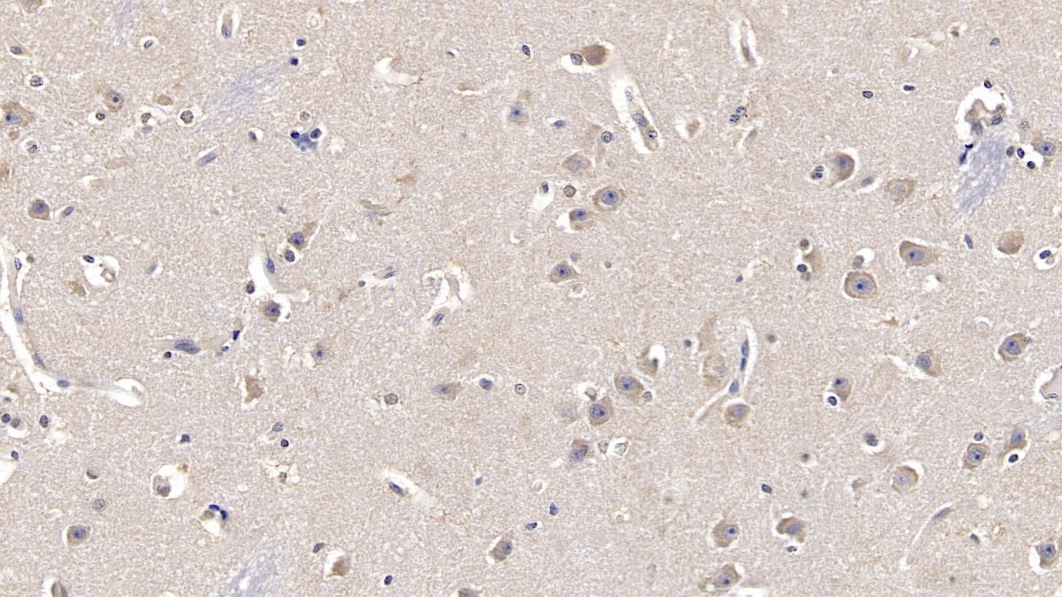 Immunohistochemistry-Paraffin: FGF-13 Antibody (C1) [NBP3-41729] - DAB staining on IHC-P; Samples: Human Cerebrum Tissue; Primary Ab: 10ug/ml NBP3-41729; Second Ab: 2ug/mL HRP-Linked Caprine Anti-Mouse IgG Polyclonal Antibody