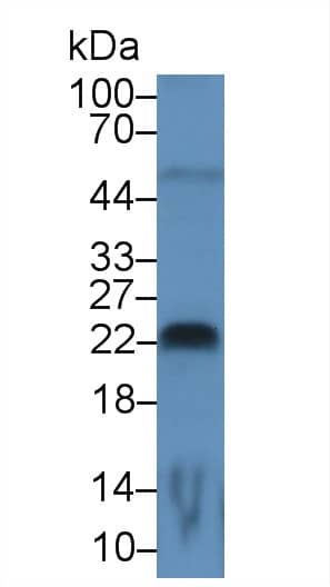 Western Blot: FGF-13 Antibody (C1) [NBP3-41729] - Sample: Rat Cerebrum lysate; Primary Ab: 3ug/ml NBP3-41729; Second Ab: 0.2ug/mL HRP-Linked Caprine Anti-Mouse IgG Polyclonal Antibody