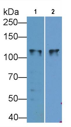 Western Blot: SLC12A3 Antibody (C2) [NBP3-41731] - Sample: Lane1: Porcine Kidney lysate; Lane2: 293T cell lysate Primary Ab: 0.8ug/ml NBP3-41731; Second Ab: 0.2ug/mL HRP-Linked Caprine Anti-Mouse IgG Polyclonal Antibody