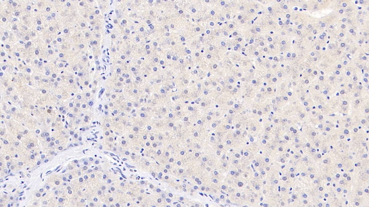 Immunohistochemistry-Paraffin: TDO2 Antibody (C1) [NBP3-41732] - DAB staining on IHC-P; Sample: Human Liver Tissue; Primary Ab: 30ug/ml NBP3-41732; Second Ab: 2ug/mL HRP-Linked Caprine Anti-Mouse IgG Polyclonal Antibody