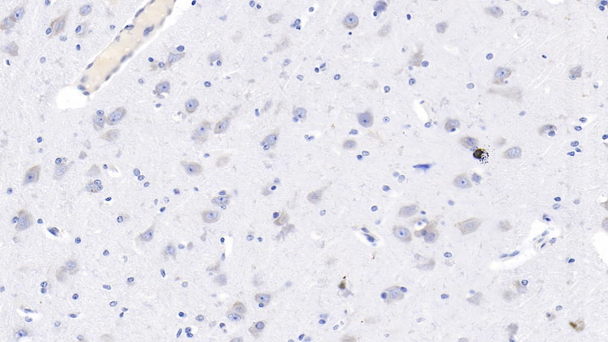 Immunohistochemistry-Paraffin: NMDA R, NR2B Subunit Antibody (C4) [NBP3-41733] - DAB staining on IHC-P; Samples: Human Cerebrum Tissue; Primary Ab: 10ug/ml NBP3-41733; Second Ab: 2ug/mL HRP-Linked Caprine Anti-Mouse IgG Polyclonal Antibody