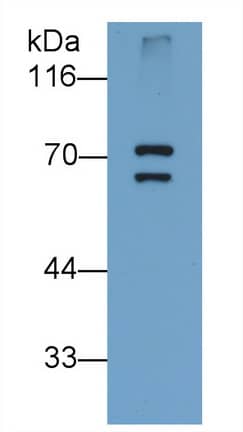 Western Blot PADI6 Antibody (D2)