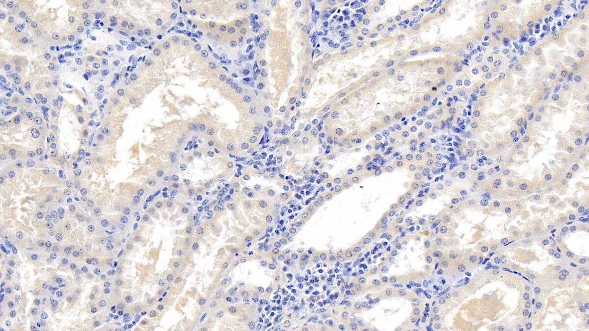 Immunohistochemistry-Paraffin: MAPRE1 Antibody (C1) [NBP3-41738] - DAB staining on IHC-P; Samples: Human Kidney Tissue; Primary Ab: 10ug/ml NBP3-41738; Second Ab: 2ug/mL HRP-Linked Caprine Anti-Mouse IgG Polyclonal Antibody