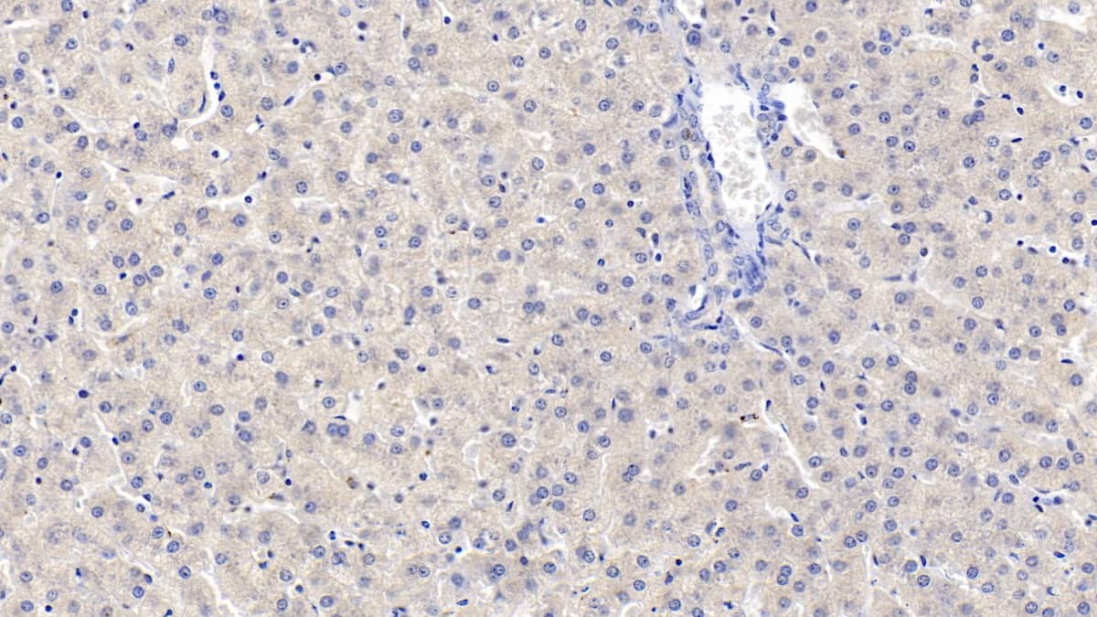 Immunohistochemistry-Paraffin: MAPRE1 Antibody (C1) [NBP3-41738] - DAB staining on IHC-P; Samples: Human Liver Tissue; Primary Ab: 10ug/ml NBP3-41738; Second Ab: 2ug/mL HRP-Linked Caprine Anti-Mouse IgG Polyclonal Antibody