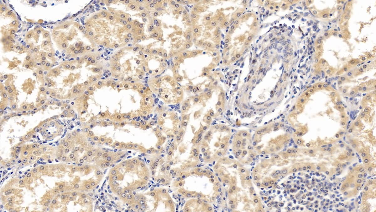 Immunohistochemistry-Paraffin: IFN-alpha F/IFNA21 Antibody (D4) [NBP3-41740] - DAB staining on IHC-P; Samples: Human Kidney Tissue; Primary Ab: 10ug/ml NBP3-41740; Second Ab: 2ug/mL HRP-Linked Caprine Anti-Mouse IgG Polyclonal Antibody