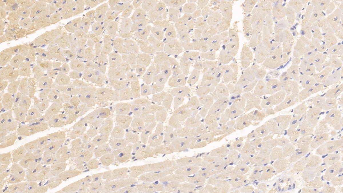 Immunohistochemistry-Paraffin: TTC11 Antibody (C1) [NBP3-41741] - DAB staining on IHC-P; Samples: Human Cardiac Muscle Tissue; Primary Ab: 30ug/ml NBP3-41741; Second Ab: 2ug/mL HRP-Linked Caprine Anti-Mouse IgG Polyclonal Antibody