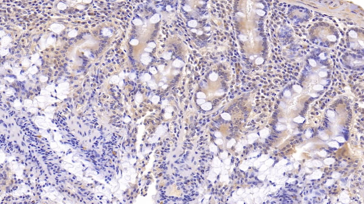 Immunohistochemistry-Paraffin: DNAH11 Antibody (C5) [NBP3-41742] - DAB staining on IHC-P; Samples: Human Small intestine Tissue; Primary Ab: 20ug/ml NBP3-41742; Second Ab: 2ug/mL HRP-Linked Caprine Anti-Mouse IgG Polyclonal Antibody