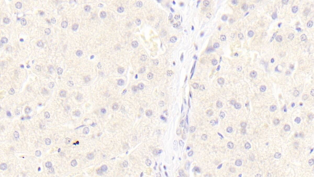 Immunohistochemistry-Paraffin: LRP-6 Antibody (C3) [NBP3-41746] - DAB staining on IHC-P; Sample: Human Liver Tissue; Primary Ab: 20ug/ml NBP3-41746; Second Ab: 2ug/mL HRP-Linked Caprine Anti-Mouse IgG Polyclonal Antibody