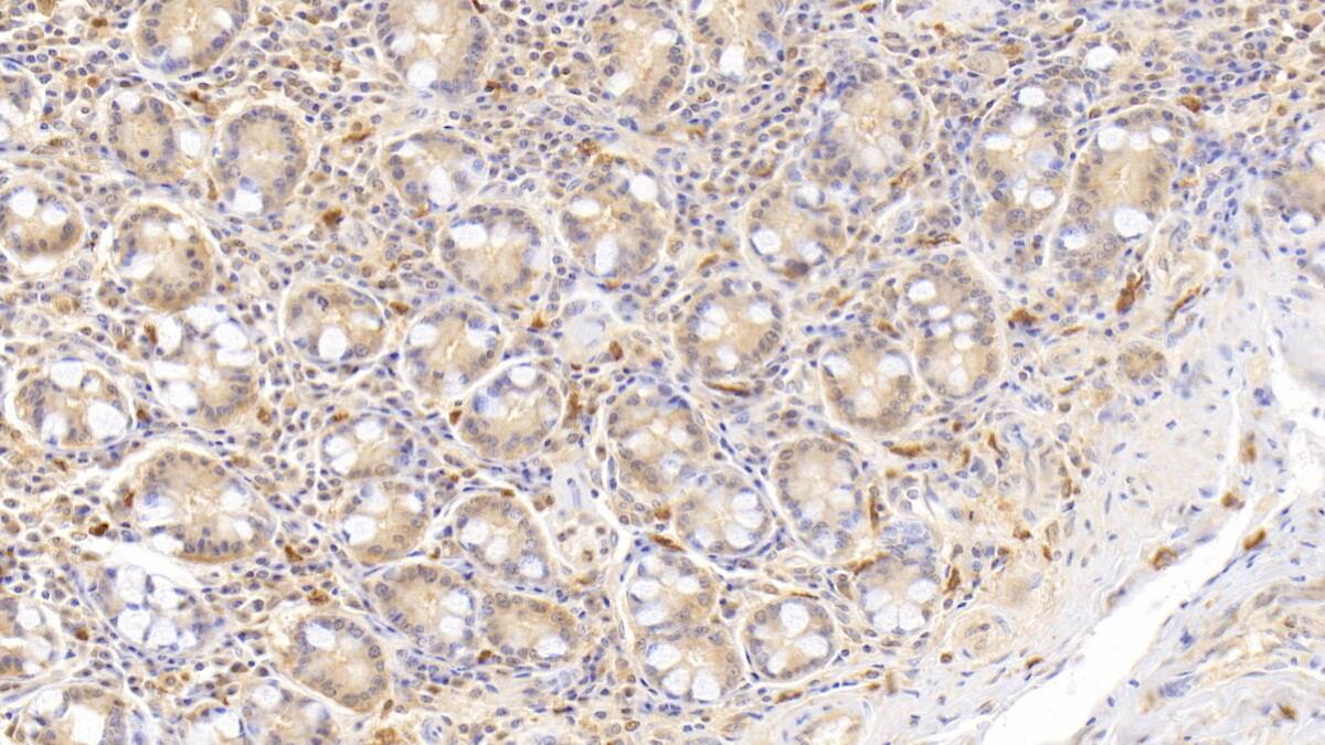 Immunohistochemistry-Paraffin: Eosinophil derived neurotoxin Antibody (C13) [NBP3-41747] - DAB staining on IHC-P; Sample: Human Small intestine Tissue; Primary Ab: 20ug/ml NBP3-41747; Second Ab: 2ug/mL HRP-Linked Caprine Anti-Mouse IgG Polyclonal Antibody