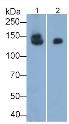 Western Blot: SI Sucrase-Isomaltase Antibody (C10) [NBP3-41748] - Sample: Lane1: Rat Small intestine lysate; Lane2: Porcine Small intestine lysate Primary Ab: 0.1ug/ml NBP3-41748; Second Ab: 0.2ug/mL HRP-Linked Caprine Anti-Mouse IgG Polyclonal Antibody